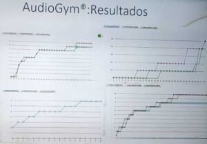 Inteligencia Artificial,audífonos,deterioro cognitivo